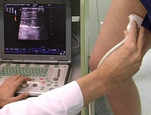 Дуплексное сканирование при посттромботической болезни нижних конечностей