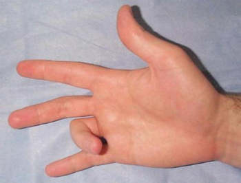 Щелкающий палец