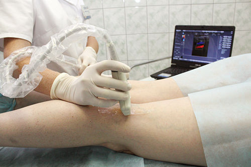 Почему не течет кровь из вены