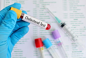 Чем опасен повышенный холестерин: причины и последствия