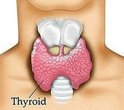 Cнижение уровня ТТГ возможно при остром тиреоидите