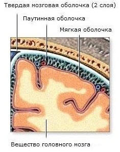 Злокачественные новообразования оболочек головного мозга